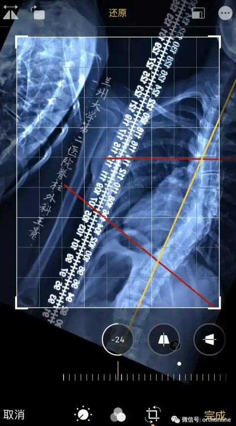 想要快速测量角度？量角器测量仪APP在线模拟、自动测算，何必再手动操作？